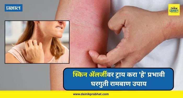 Skin Allergies : मुरूम, खाज आणि लाल चट्टे ! स्किन अॅलर्जीवर ट्राय करा ‘हे’ प्रभावी घरगुती रामबाण उपाय