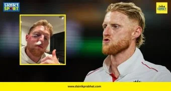 Ben Stokes Injury : धक्कादायक! बेन स्टोक्सच्या चेहऱ्याला गंभीर दुखापत; थोडक्यात वाचला डोळा, फोटो होतोय व्हायरल