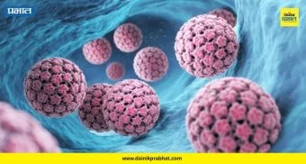What is HPV: कॅन्सरला हरवायचेय? मग 'HPV' ला समजून घेणे आहे काळाची गरज!