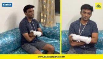 Viraj Jagtap : महाराष्ट्राची हास्यजत्रा फेम अभिनेत्याचा अपघात; हातावर शस्त्रक्रिया करण्याची वेळ, नेमकं काय घडलं?