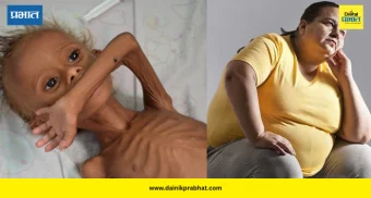 Diet & Nutrition: आहारातील त्रुटींमुळे देशात ‘दोन भारत’; ४०% लोकांमध्ये सूक्ष्म पोषकद्रव्यांची कमतरता