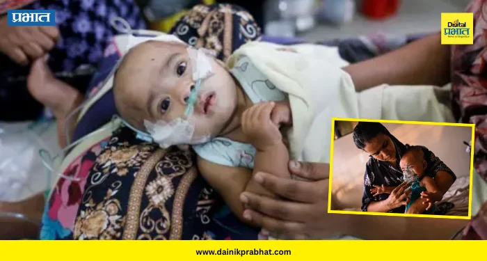 Bangladesh : बांगलादेशात गोवरमुळे १०० बालकांचा मृत्यू; देशभरात लसीकरणाची धडक मोहिम सुरू
