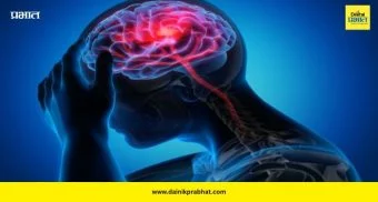 Migraine: मायग्रेन वाढवणाऱ्या चुका टाळा! तज्ञ सांगतात 'हे' सोपे उपाय