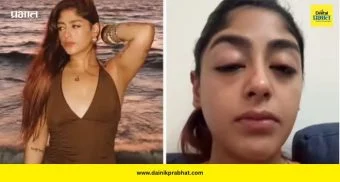 Preet Singh: ‘स्प्लिट्सविला 16’ची प्रीत सिंग मारहाणीची शिकार; सूजलेल्या चेहऱ्यासह व्हिडिओ व्हायरल