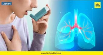 Asthma Action Plan: अस्थमाच्या अचूक निदानासाठी 'अस्थमा ॲक्शन प्लॅन' महत्वाचा - डॉ. राहुल केंद्रे