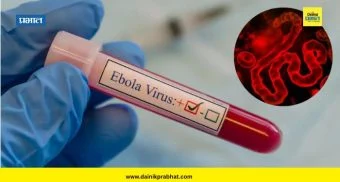 Ebola : इबोलाबाबत जागतिक आरोग्य संघटनेकडून आणीबाणी जाहीर