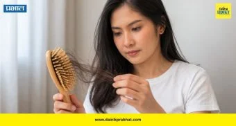 Hair Fall: अॅसिडिटीमुळे वाढते का केस गळती? जाणून घ्या तज्ज्ञांचे मत