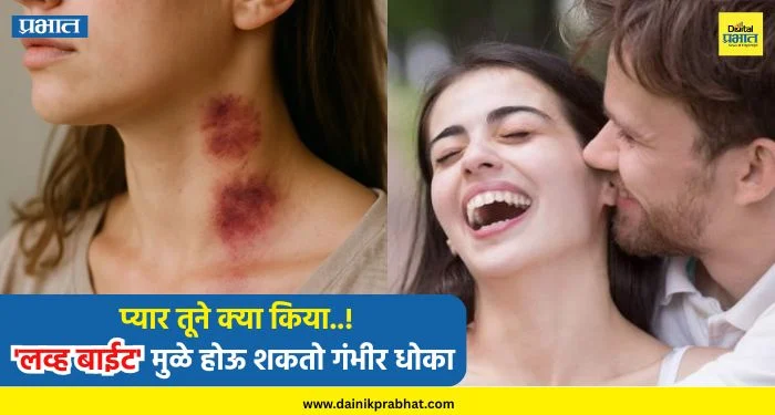 Love Bite Side Effects : प्यार तूने क्या किया..! ‘लव्ह बाईट’ मुळे होऊ शकतो गंभीर धोका, आत्ताच सावध व्हा !