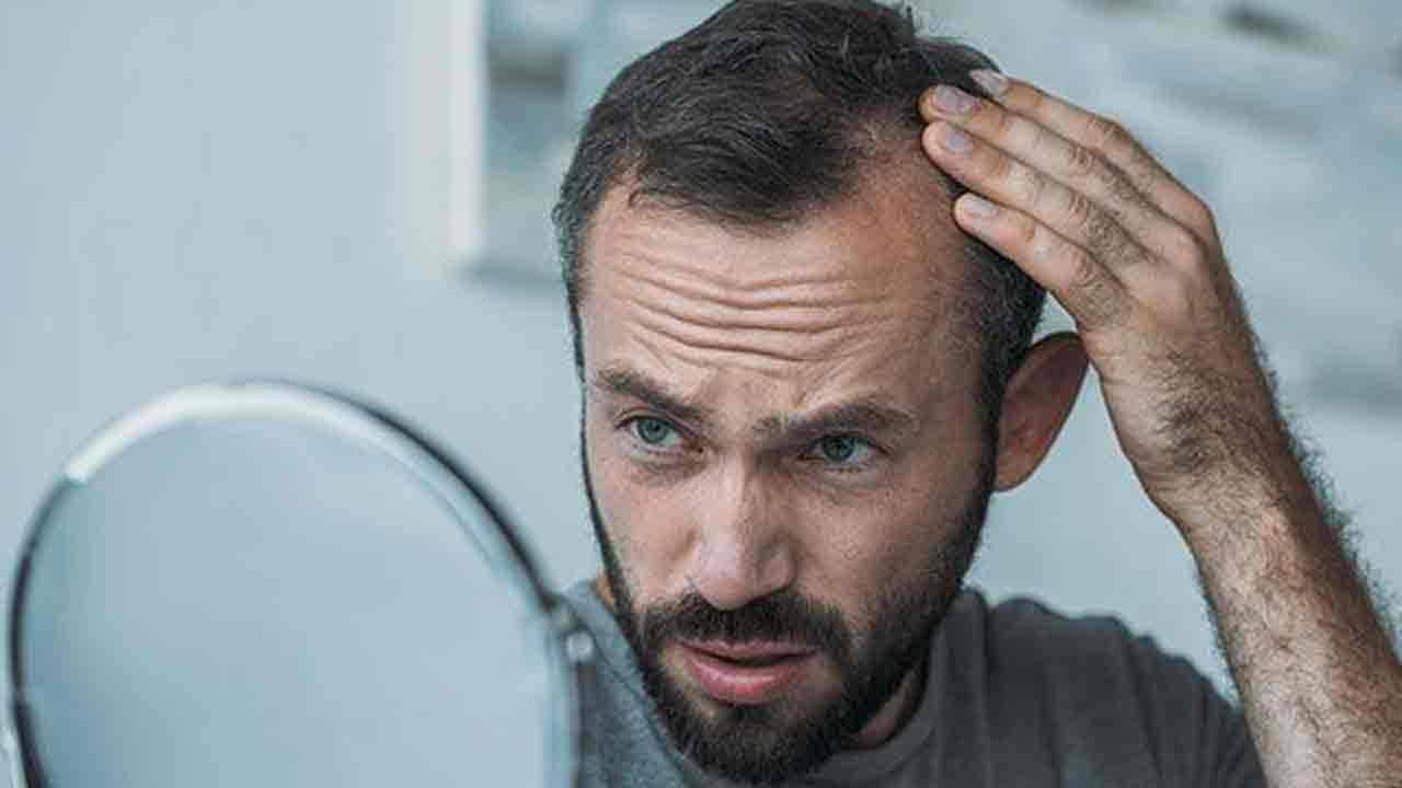 Male baldness | మగాళ్లకు గుడ్న్యూస్.. బట్టతల మీద మళ్లీ వెంట్రుకలు వస్తాయట.. కొత్త ఆశలు రేకెత్తిస్తున్న పరిశోధనలు