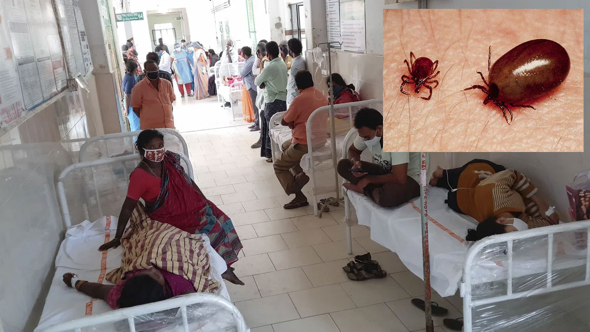 Scrub Typhus | ఏపీని వణికిస్తున్న స్క్రబ్ టైఫస్ వ్యాధి.. ఆ లక్షణాలు కనిపిస్తే వెంటనే ఆసుపత్రికి వెళ్లండి