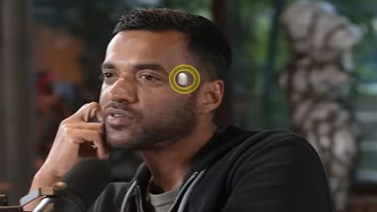 Deepinder Goyal | జొమాటో ఫౌండర్ తలకు విచిత్ర పరికరం.. దాన్ని చూసి నెటిజన్లు షాక్